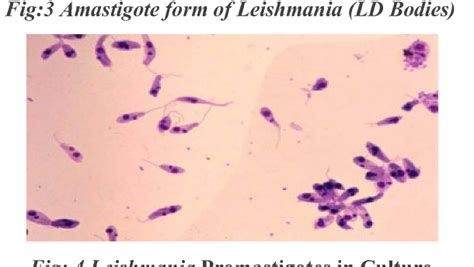  Leishmania donovani: Kestojäädytettyjä loisia ja trooppista kuumetta yhdistävä mikroskooppinen maailma!